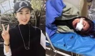 八达岭老虎伤人的事件